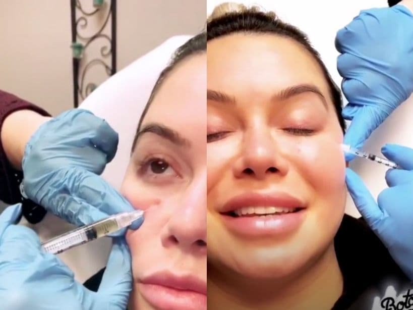 Chiquis Rivera también ha optado por aplicarse Toxina Butulínica para disminuir las líneas de expresión y el PRP, con el objetivo de estimular el colágeno de su cuerpo. “Es para que no me salgan pequeñas arrugas junto a los ojos y para que se vean más brillantes y felices”, escribió en su historias de Instagram.