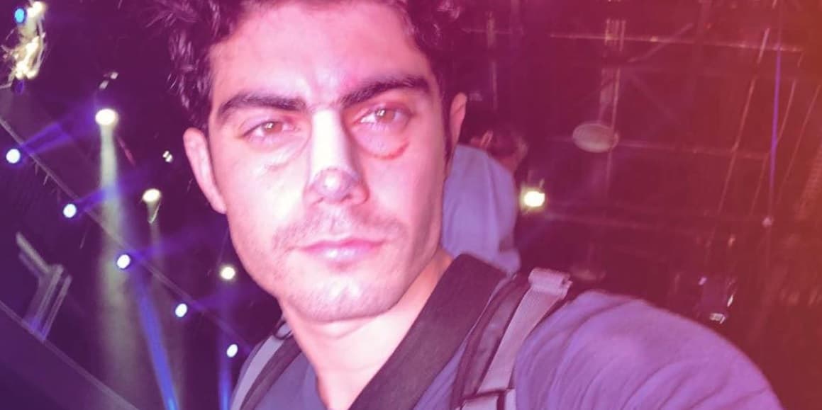 El actor sufrió varios golpes