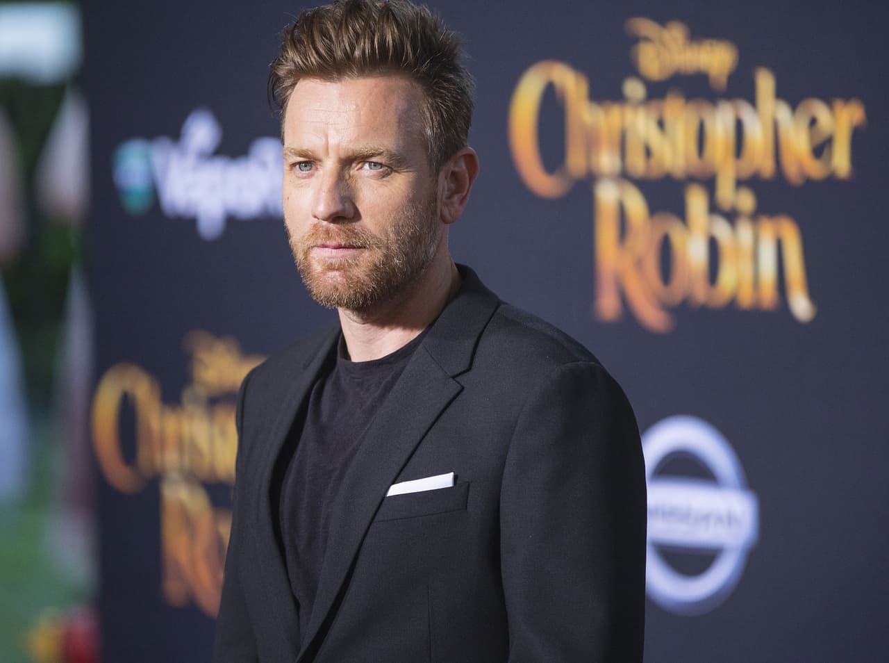 En 2008, Ewan McGregor reveló a la BBC que se percató de un lunar debajo de su ojo derecho, por lo que acudió con un especialista para retirarlo. “Tienes que tener cuidado si eres de piel pálida y pasas tiempo bajo el sol”, declaró.