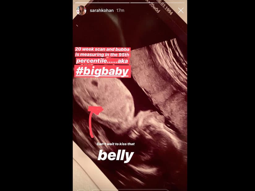 Sarah Kohan comparte el ultrasonido de su bebé
