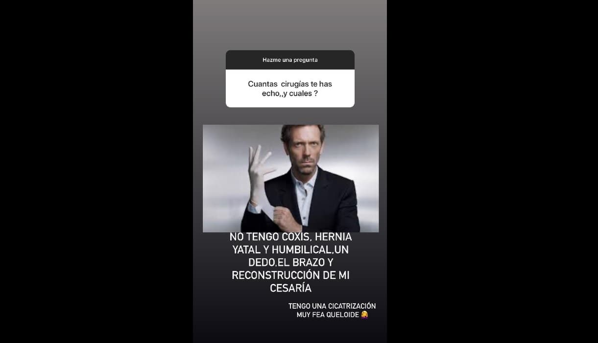 La actriz dio detalles de las intervenciones a las que se ha sometido.